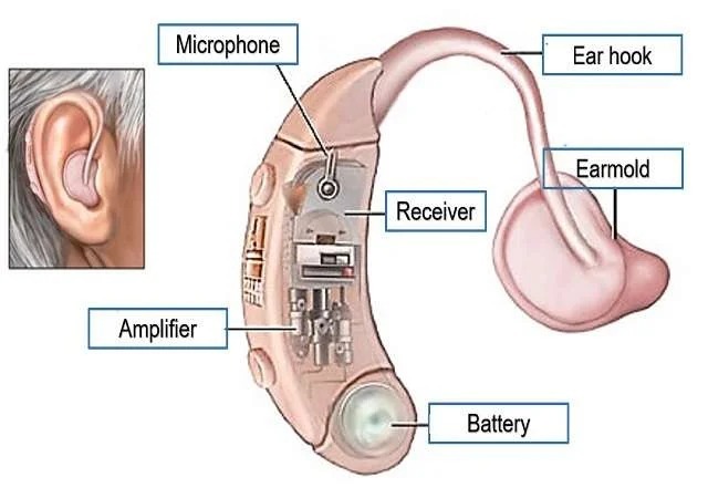 circuitry